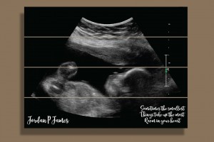 Babyultrasound (1)